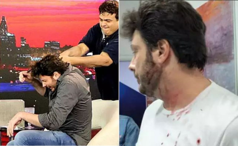 Após agressão, Danilo Gentili sai sangrando de entrevista e SBT se pronuncia